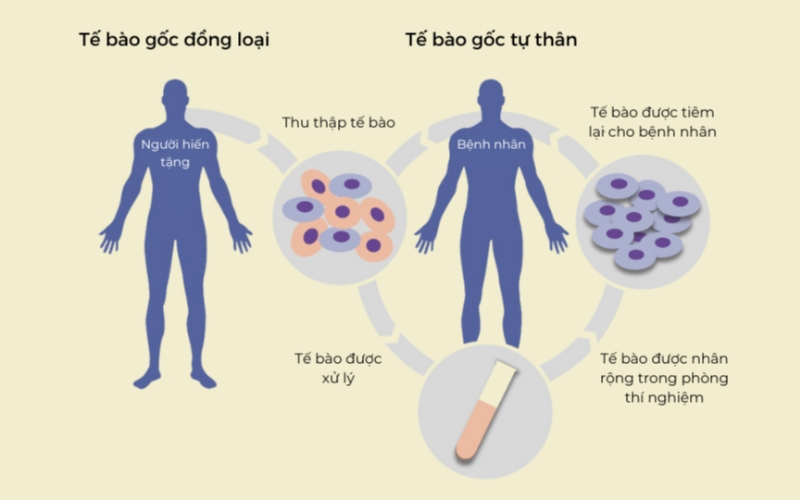Tế bào gốc trong làm đẹp