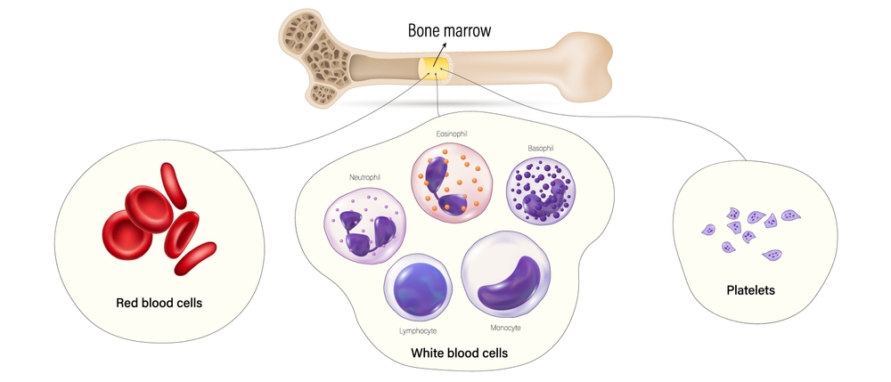 Bone Marrow Stem Cells